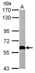 Anti-COL4A3BP antibody [C3], C-term used in Western Blot (WB). GTX108337